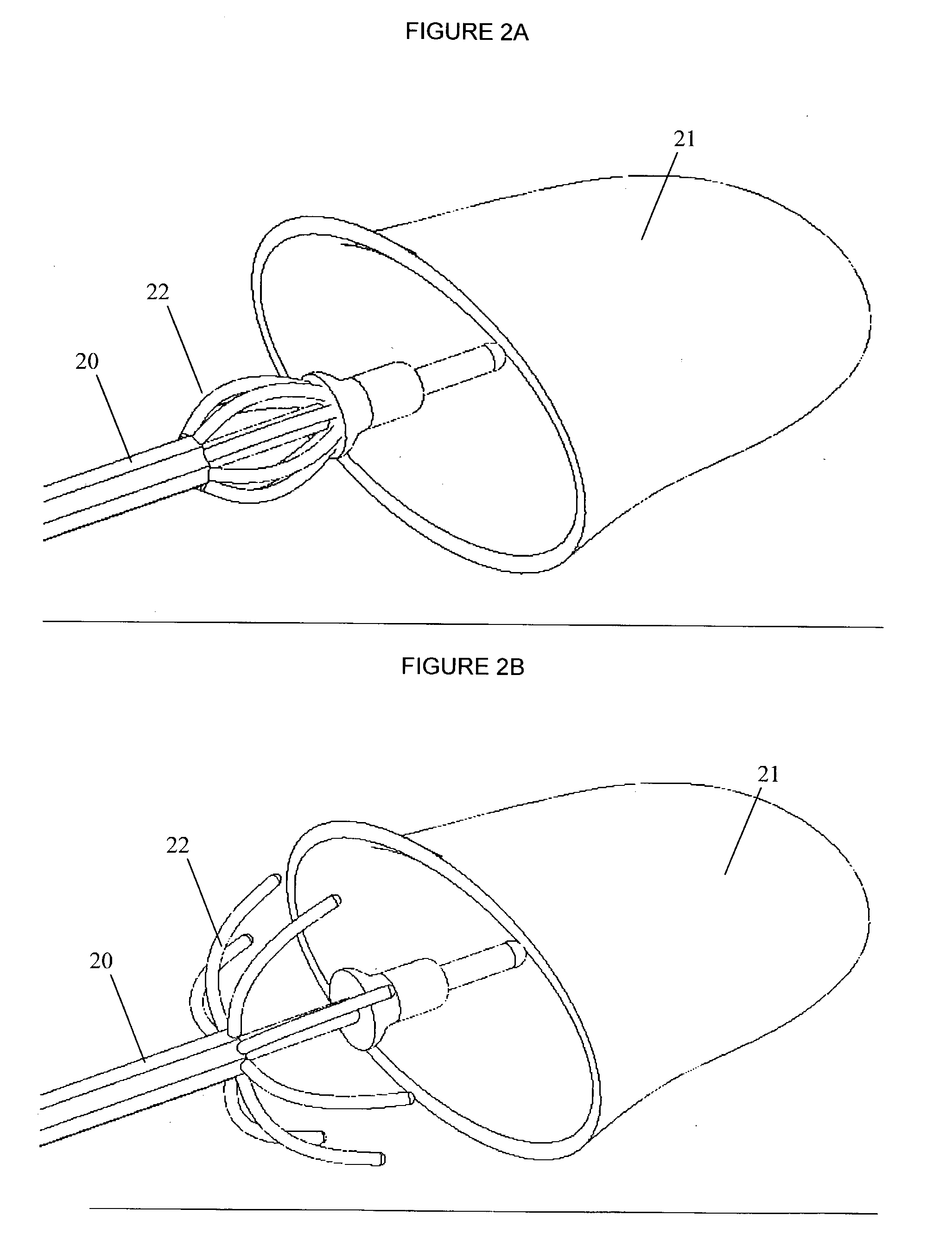 Methods and devices for modulating atrial configuration