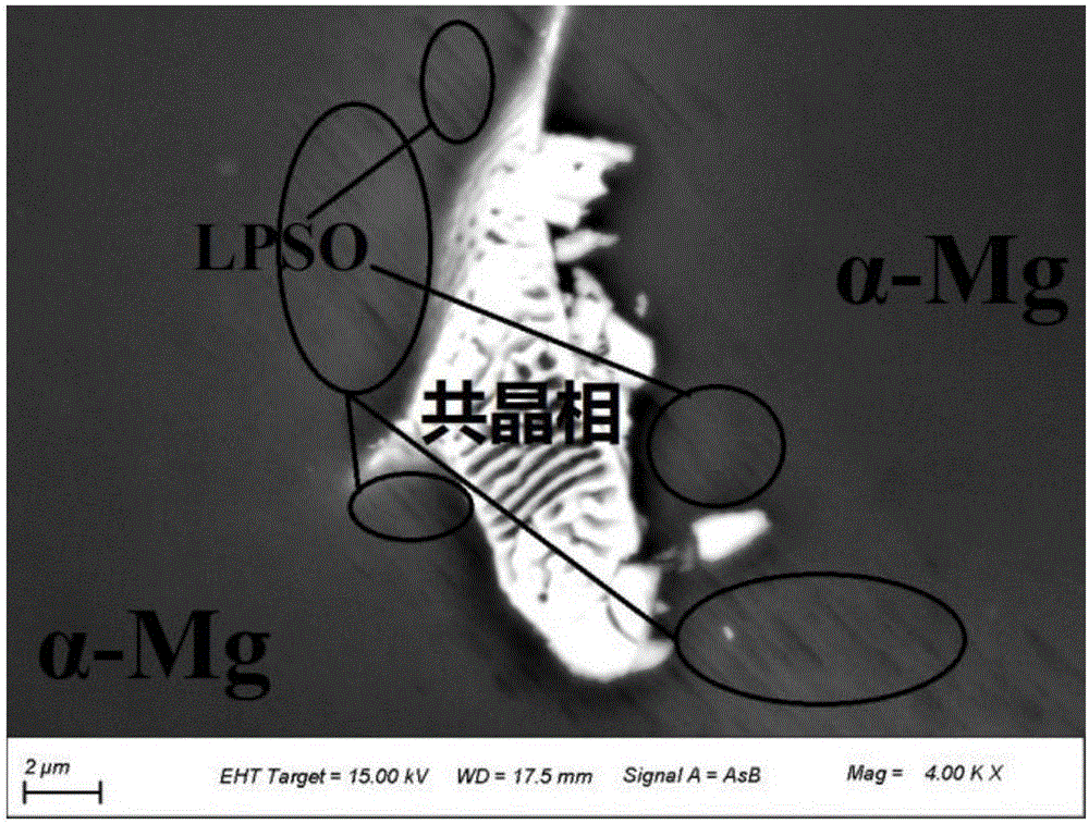 Medical Mg-Gd-Zn (-Ca) magnesium alloy with LPSO structure and preparation method thereof