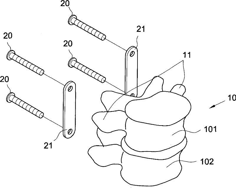 Fixing device for neutralizing actions between two vertebral bodies