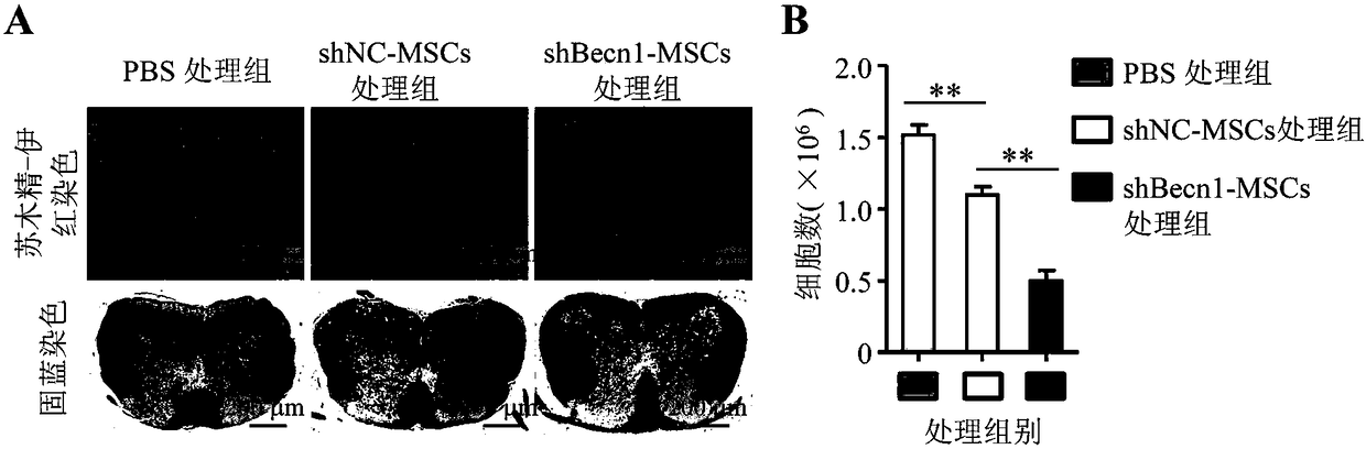 Application of inhibiting autophagy of mesenchymal stem cells in autoimmune diseases