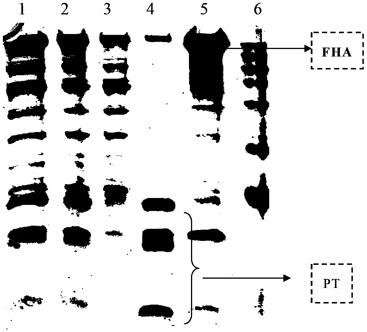 Production method of acellular pertussis vaccine