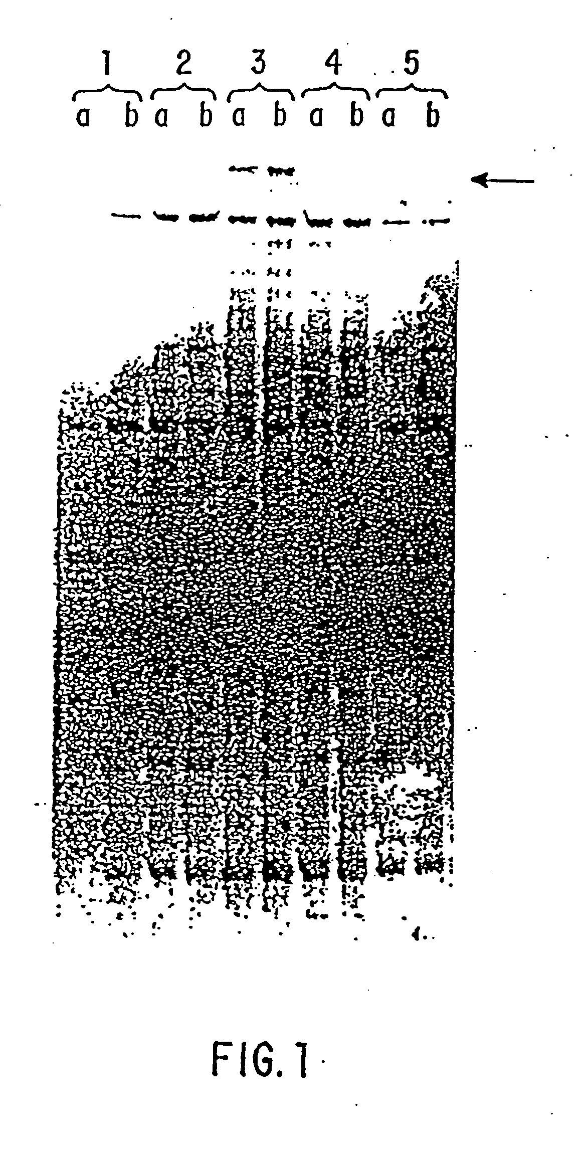 Compositions and methods for the treatment and diagnosis of immune disorders