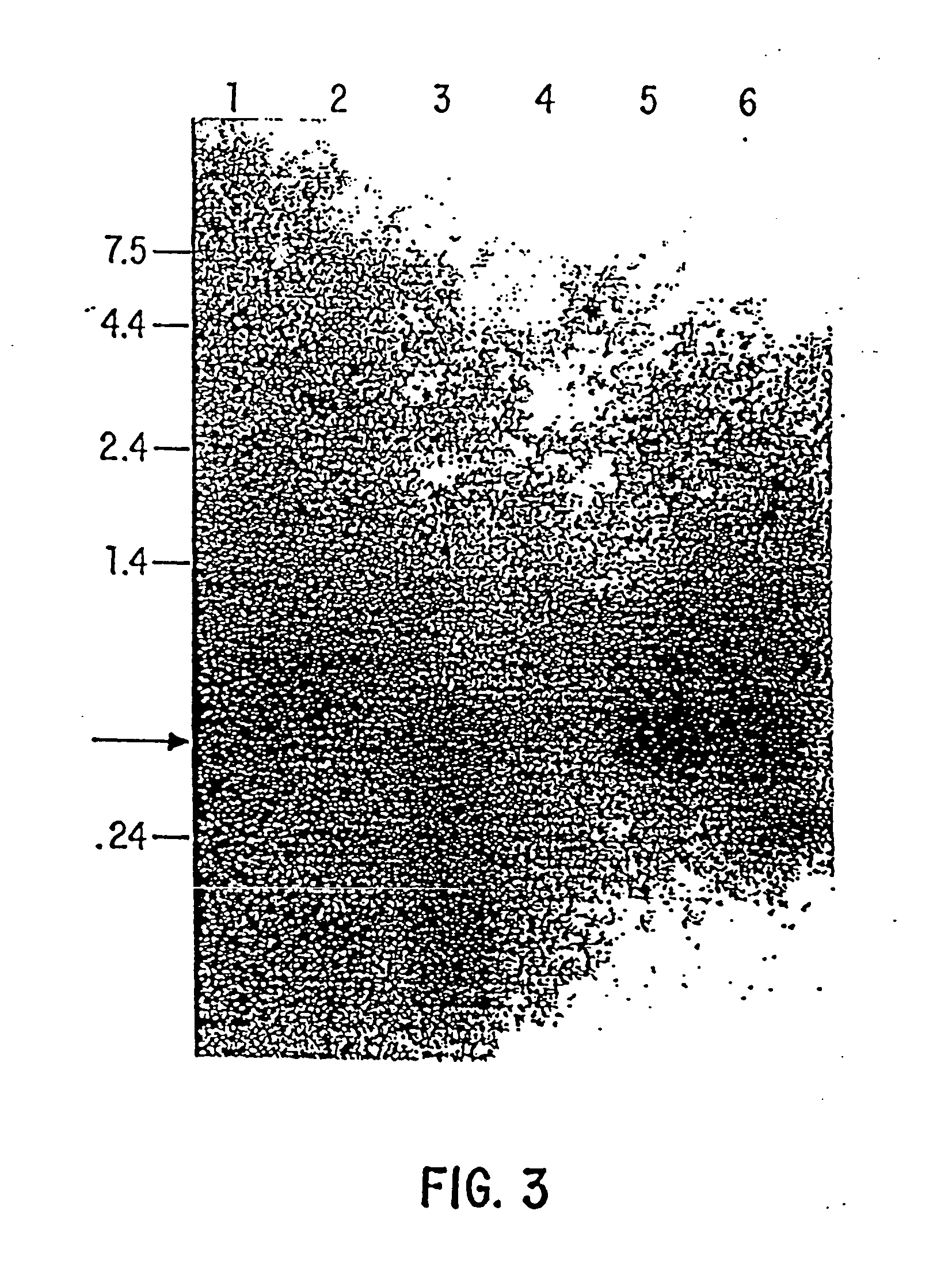 Compositions and methods for the treatment and diagnosis of immune disorders