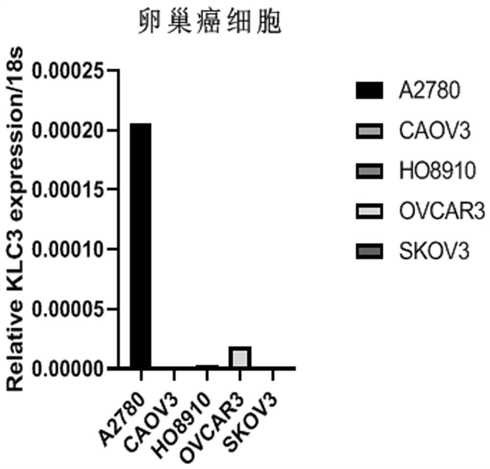 Application of KLC3 gene as marker in diagnosis and treatment of lung cancer, gastric cancer, colorectal cancer, endometrial cancer and ovarian cancer