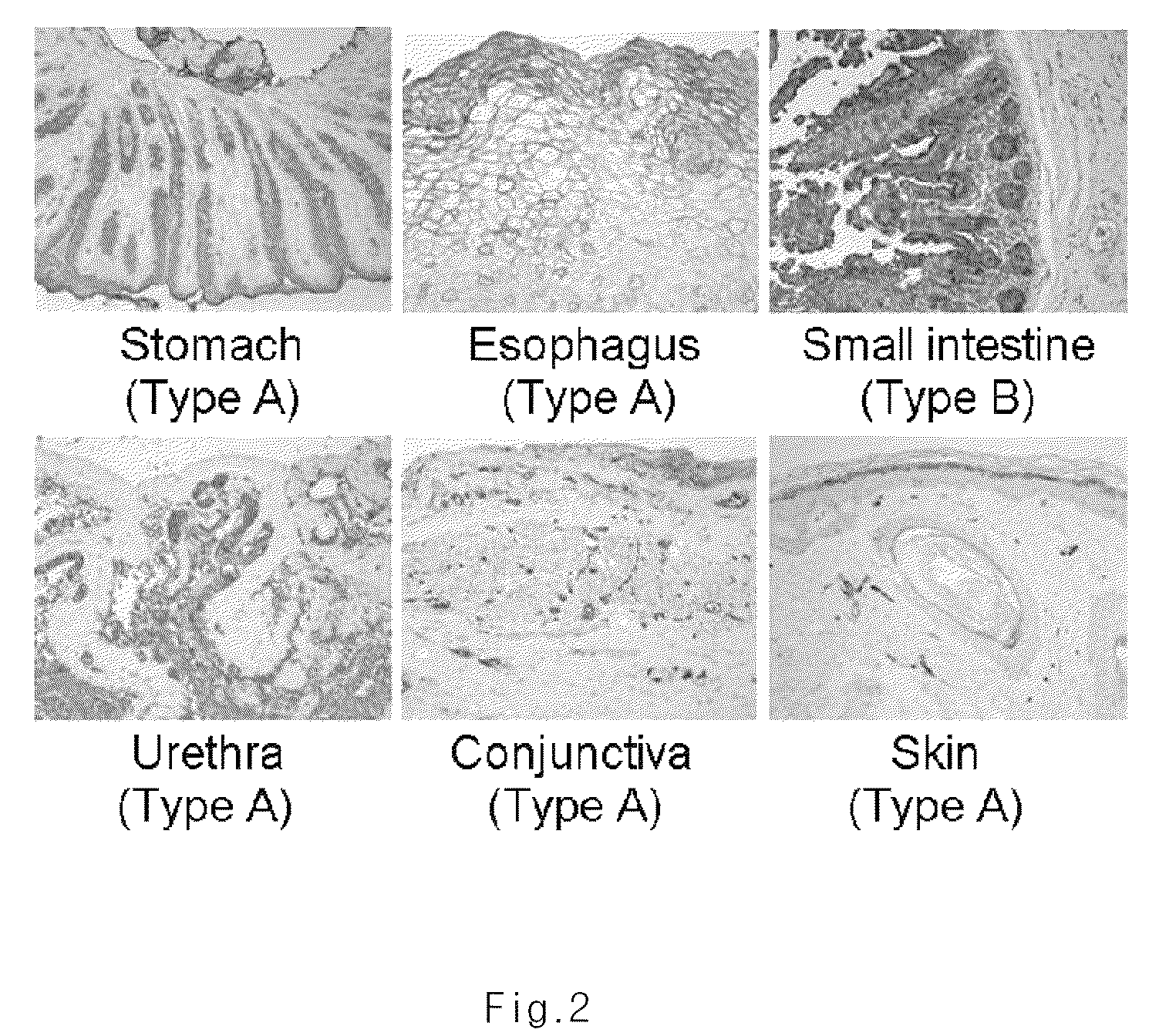 Composition for improving inflammatory disease using ABH antigens