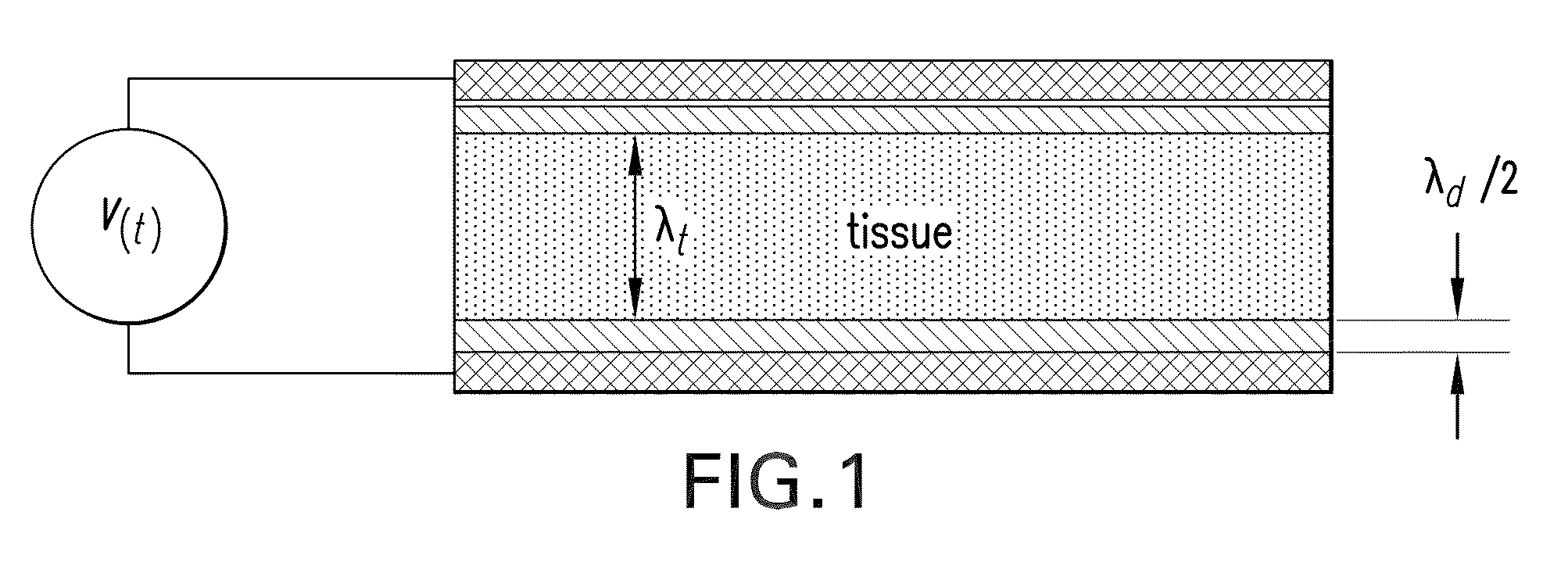 Electrode geometries and method for applying electric field treatment to parts of the body