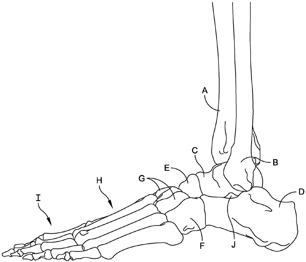 Posterior ankle fusion plate
