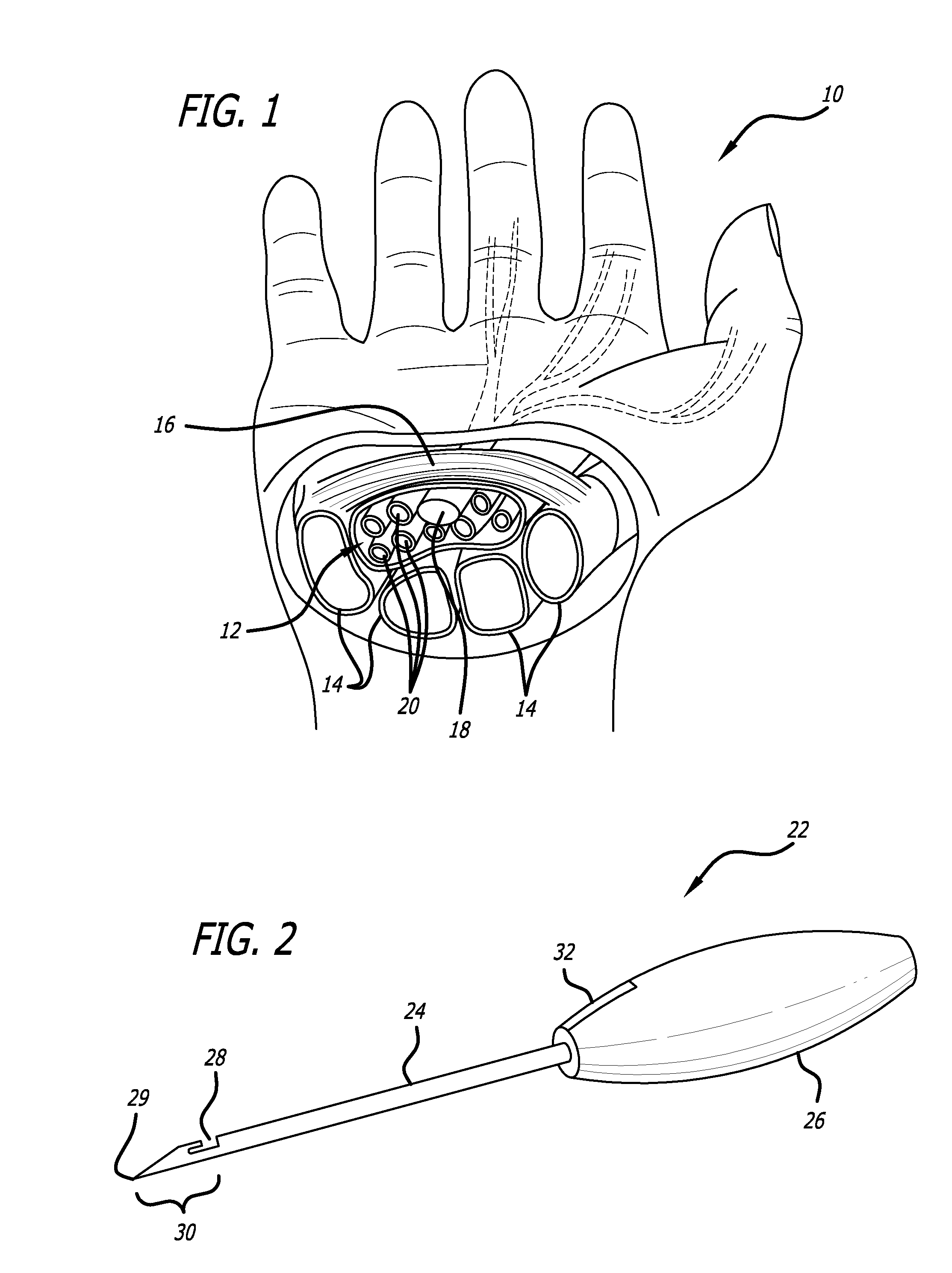 Method and apparatus for thread transection of a ligament