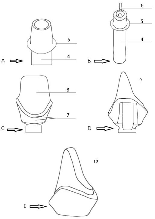 A method for reducing the formation of residual adhesive in the process of cement-retained implant repair