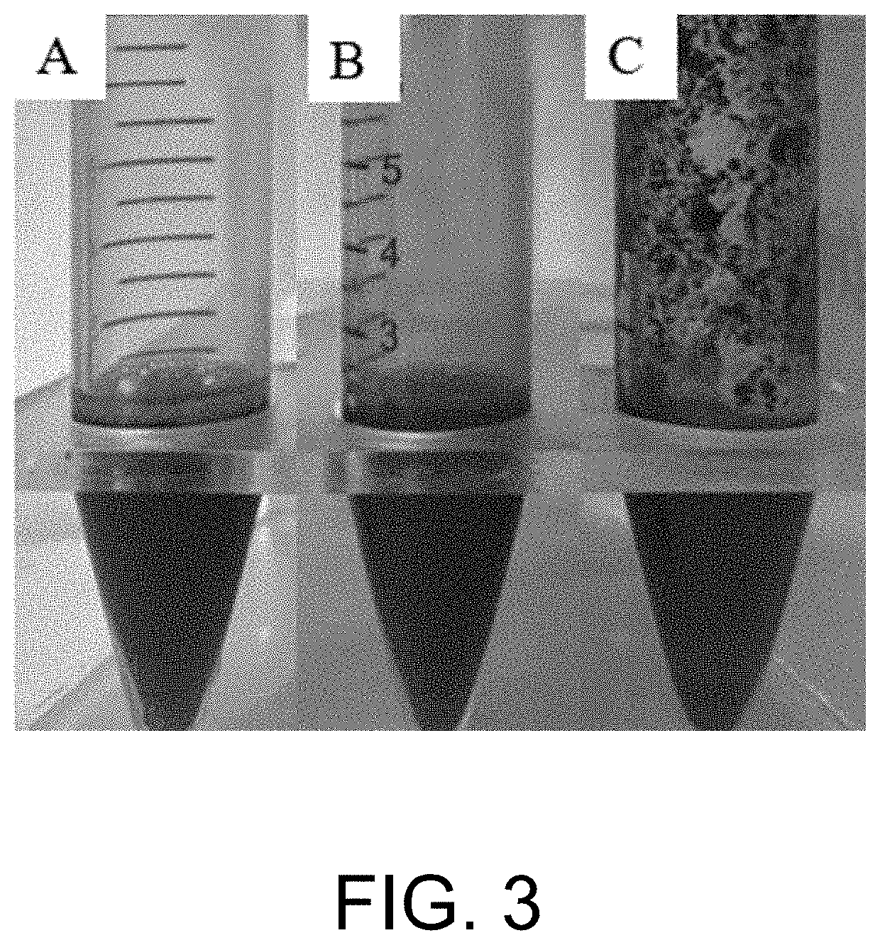 Ethanol foam sclerosing agent for treating vascular anomalies and preparation method thereof