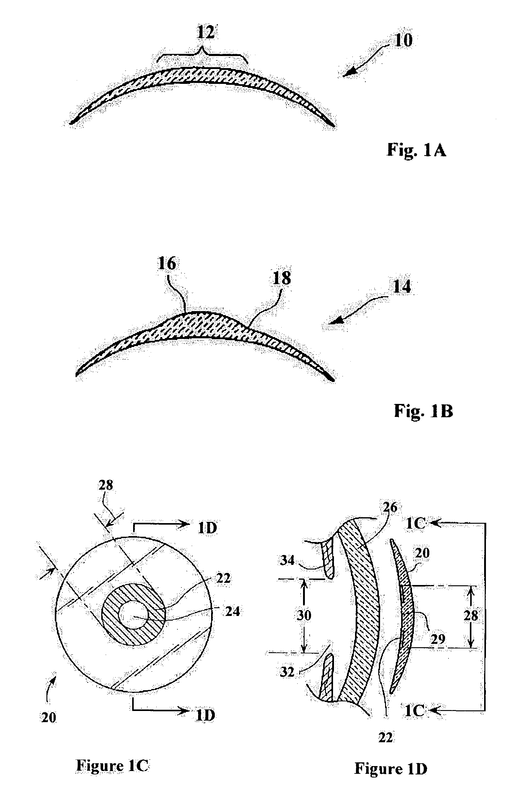 Methods for producing epithelial flaps on the cornea and for placement of ocular devices and lenses beneath an epithelial flap or membrane, epithelial delaminating devices, and structures of epithelium and ocular devices and lenses