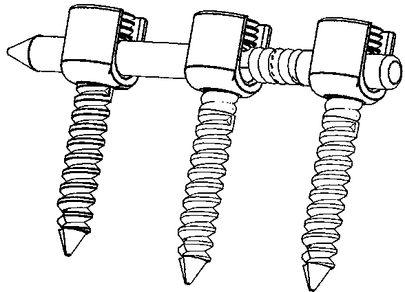 Bi-flexible vertebral arch pedicle screw rod fixation system for screw rod