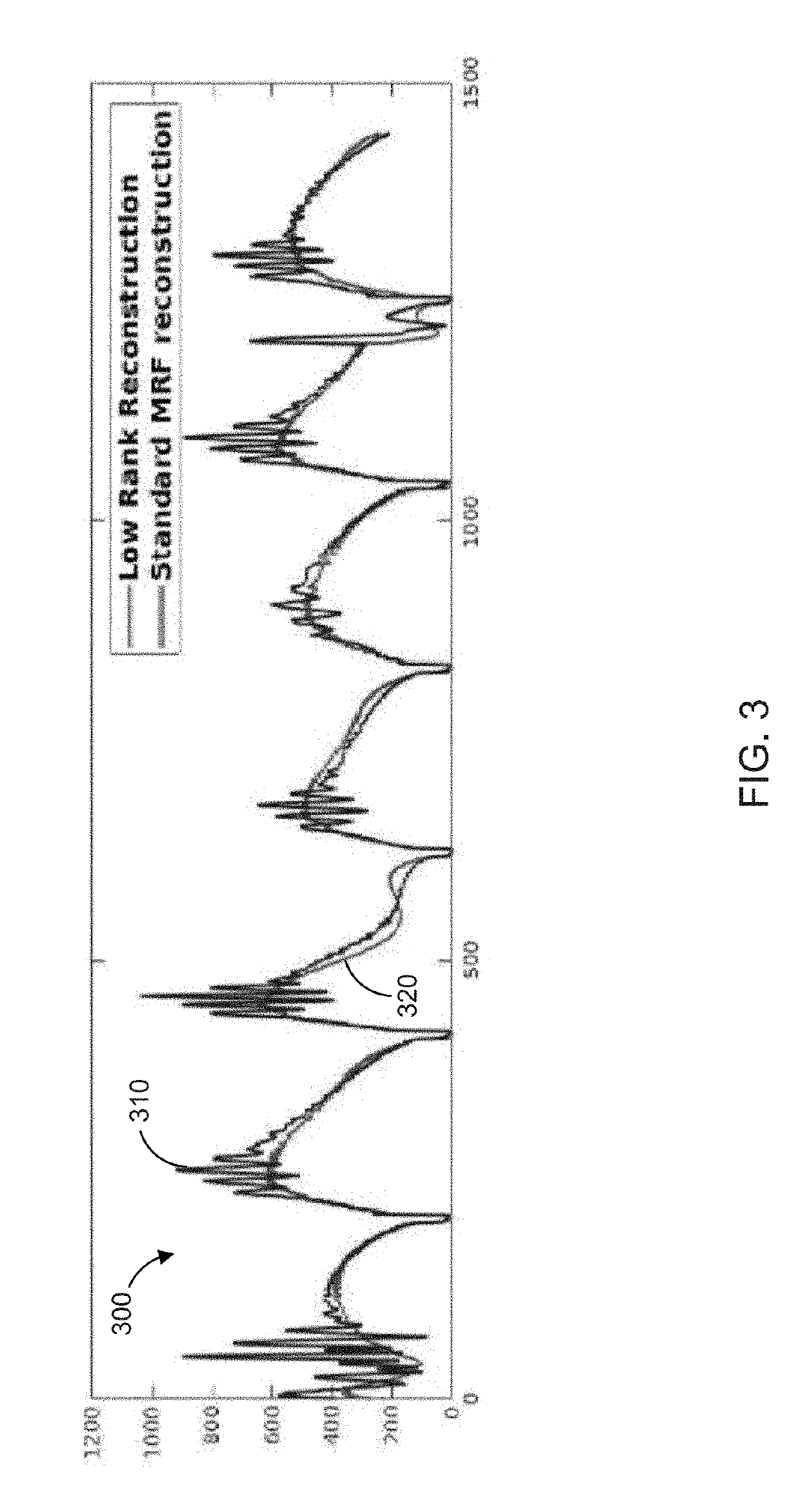 Blind Source Separation in Magnetic Resonance Fingerprinting