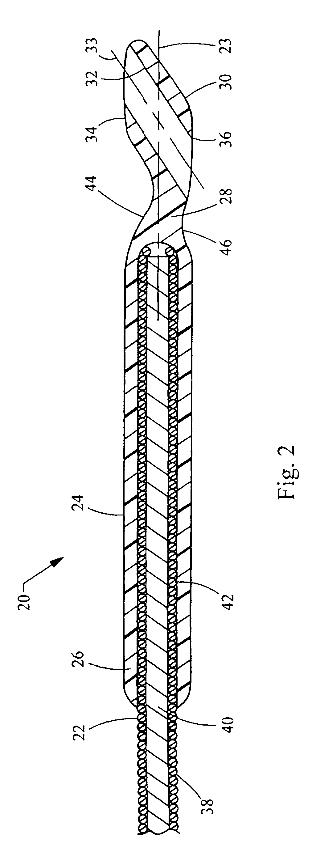 Wire guide having distal coupling tip