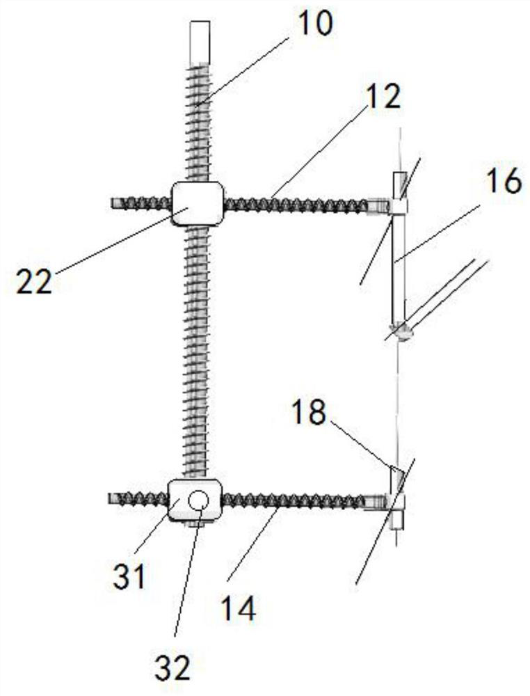 Acetabulum posterior column screw guider