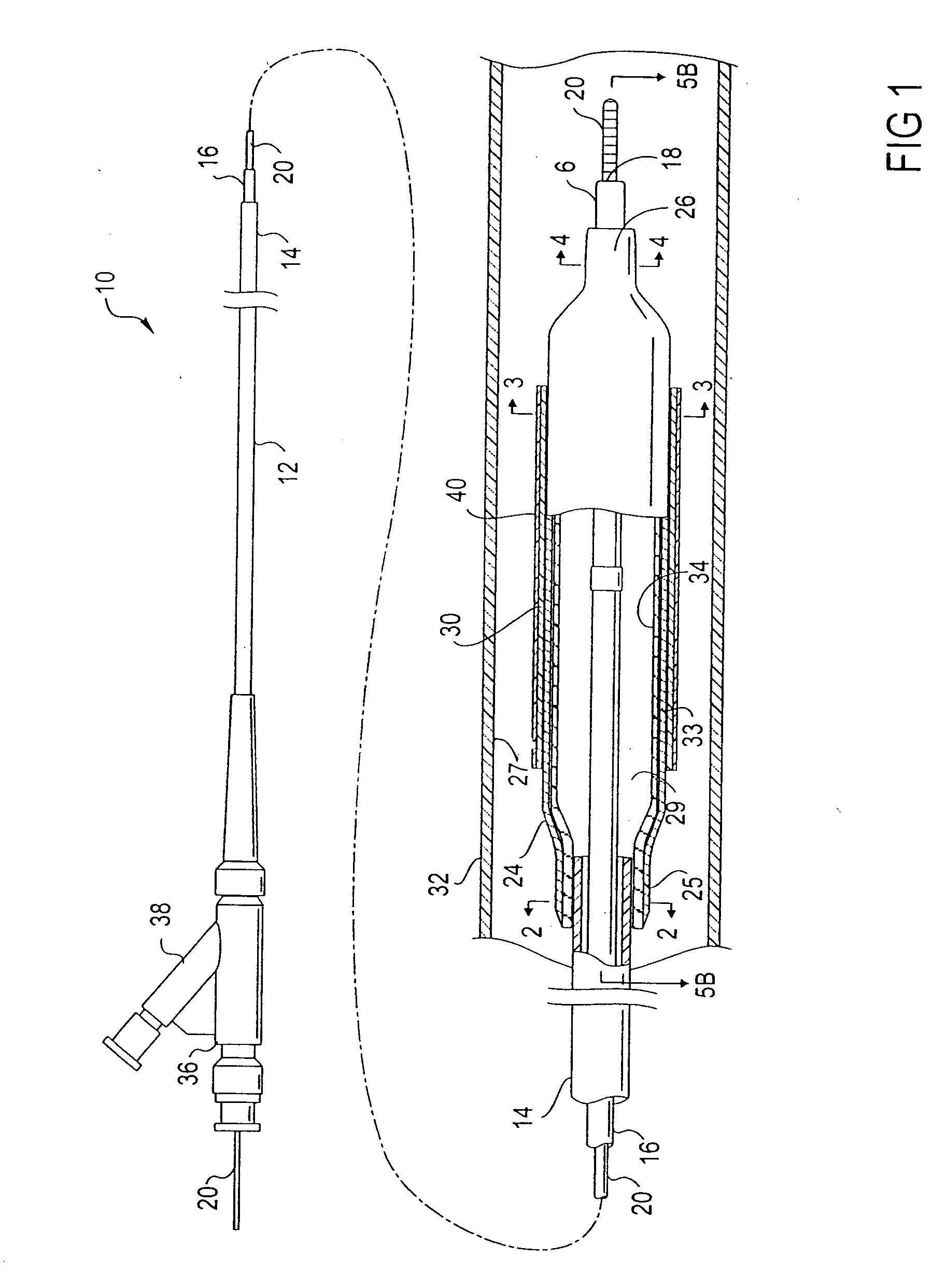 Catheter balloon liner with variable thickness and method for making same
