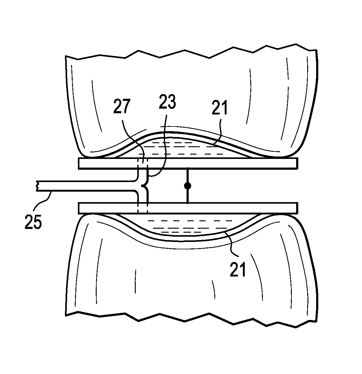 Patient-specific spinal fusion cage and methods of making same