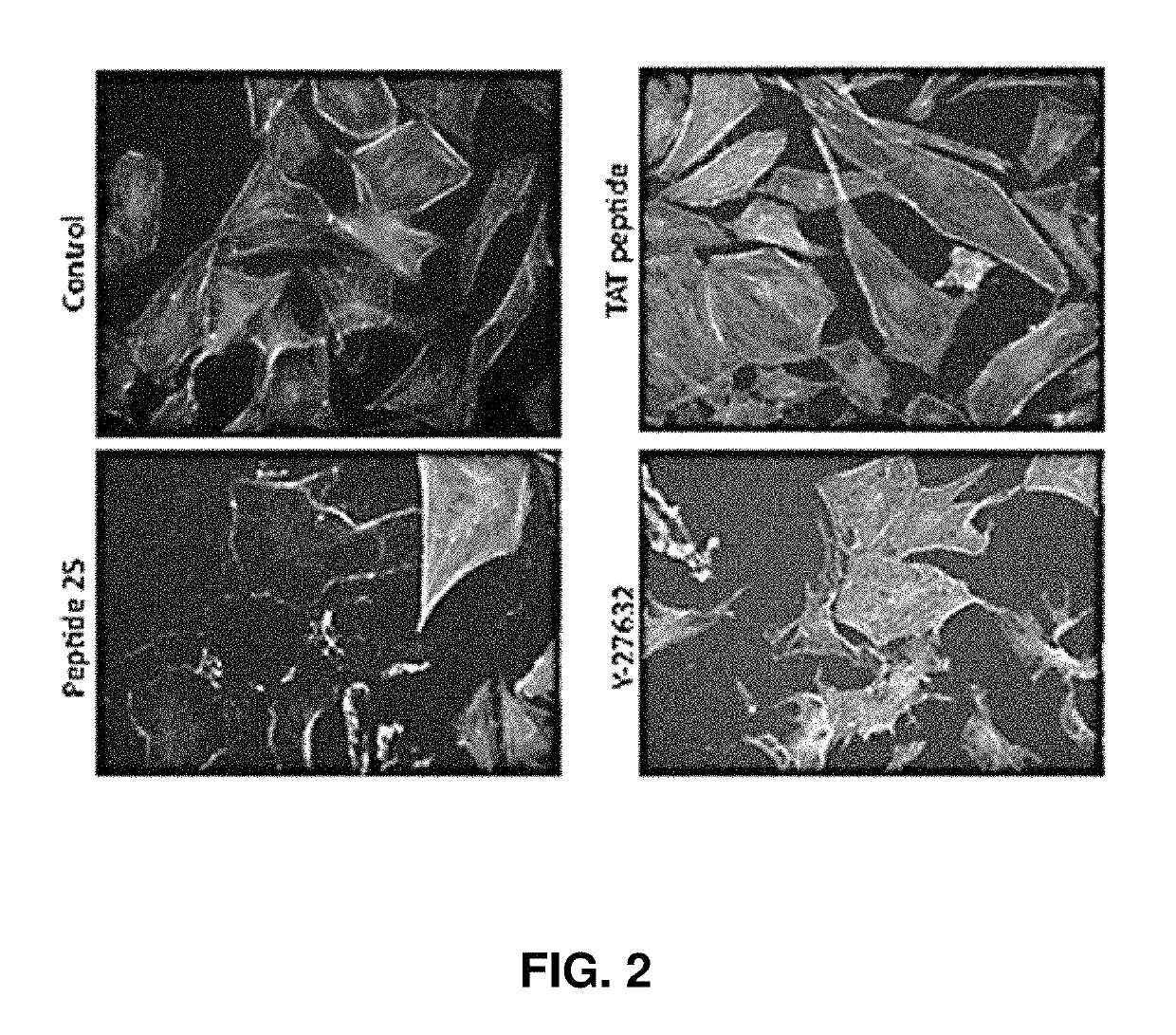 Rho associated kinase (ROCK) inhibitors and their use in treating disease