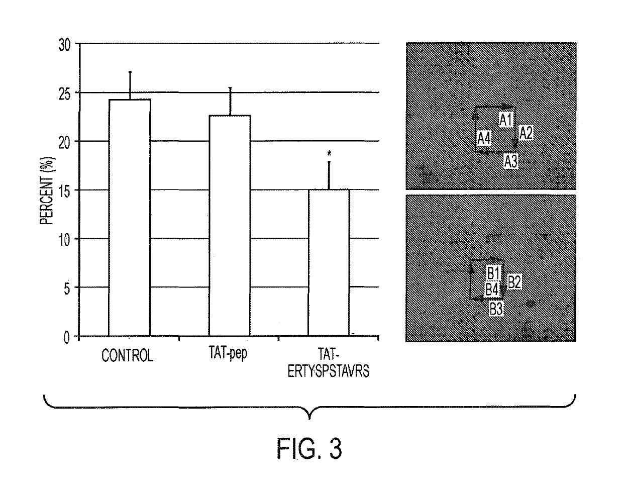 Rho associated kinase (ROCK) inhibitors and their use in treating disease