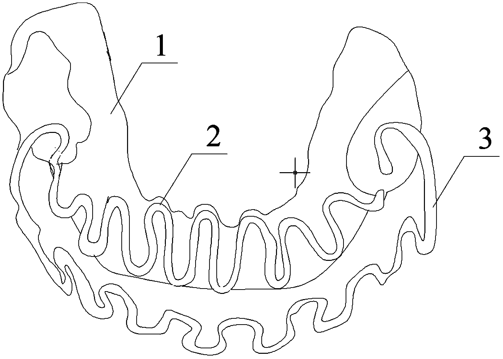 Interactive appliance of upper and lower jaws