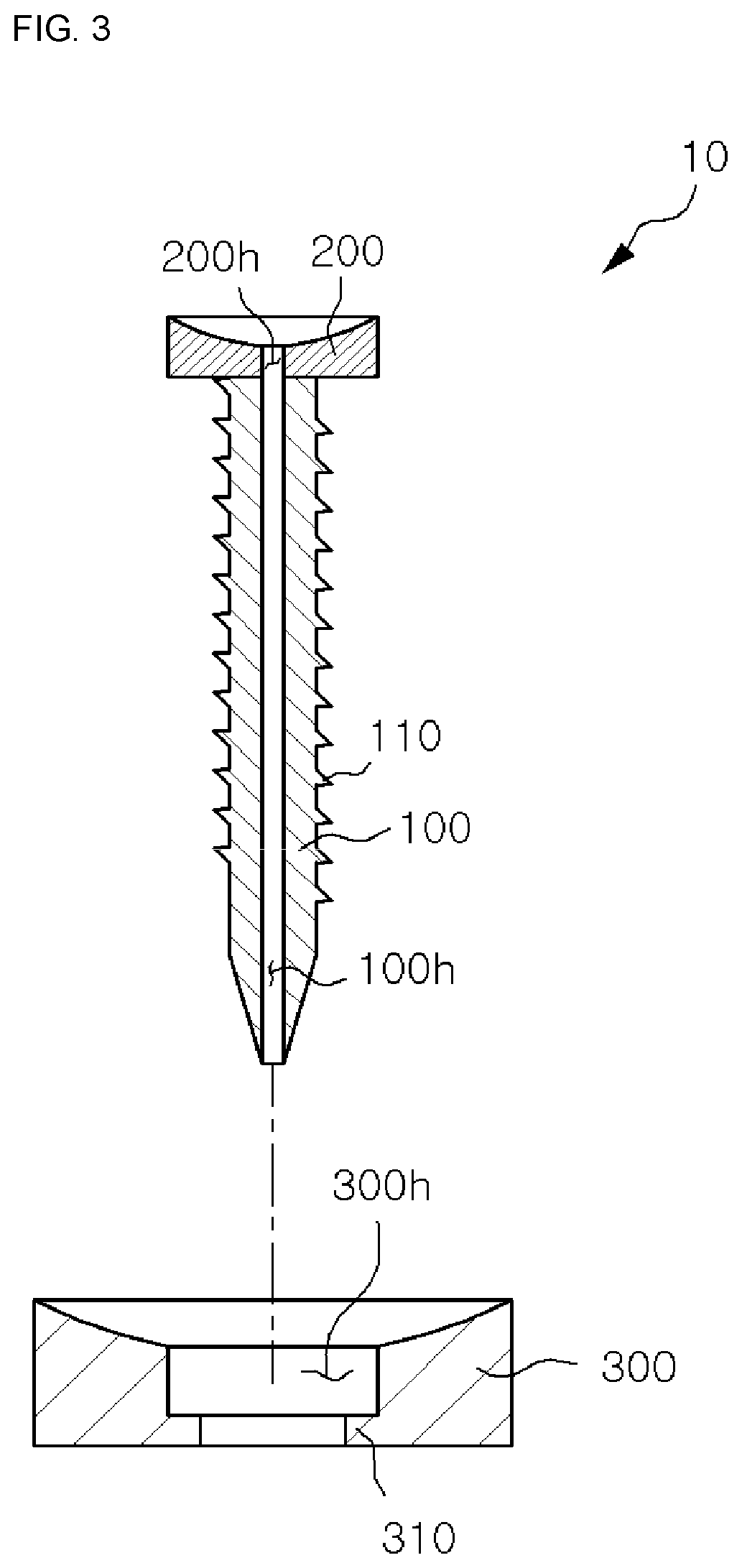 Cannulated screw