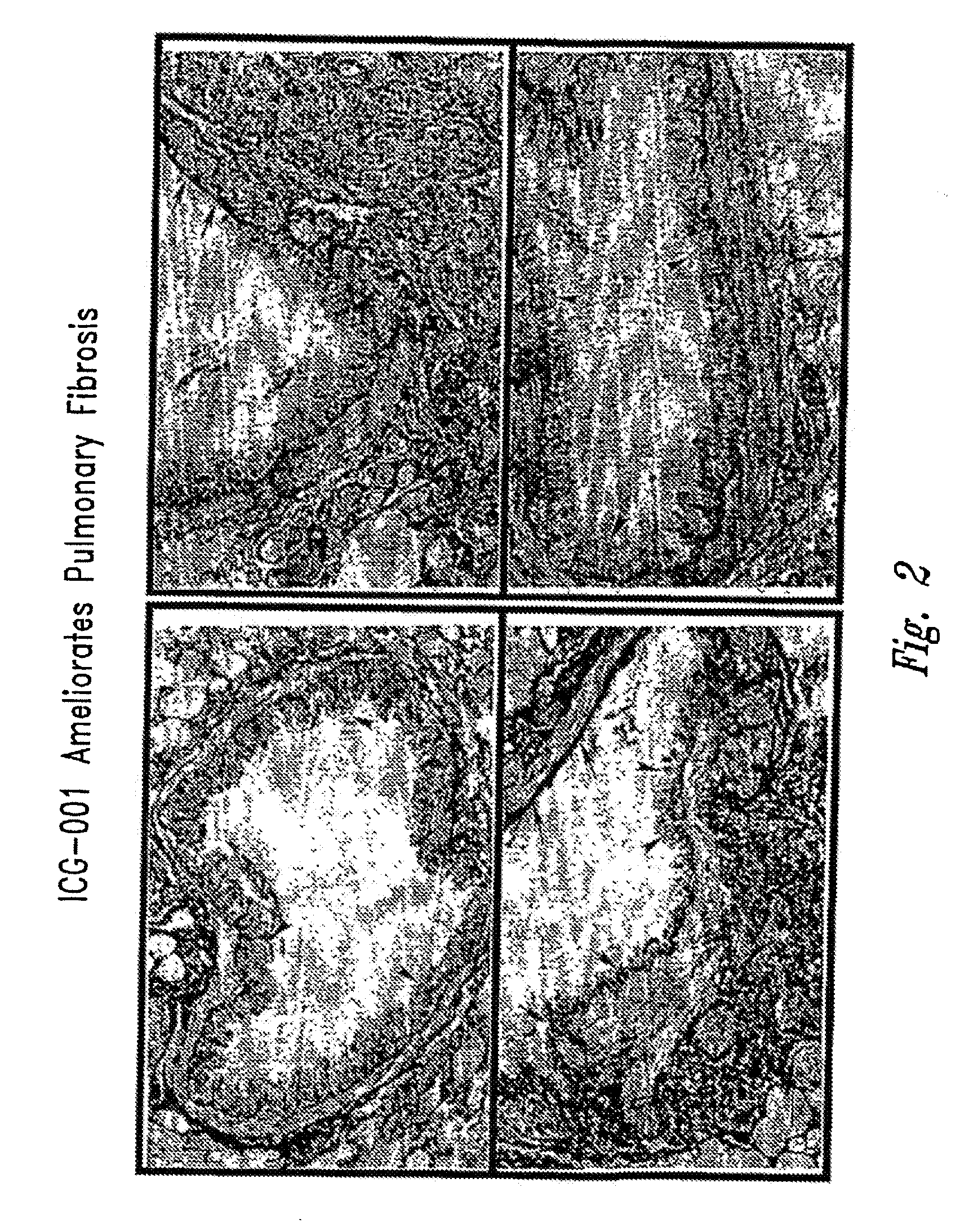 Methods relating to the treatment of fibrosis