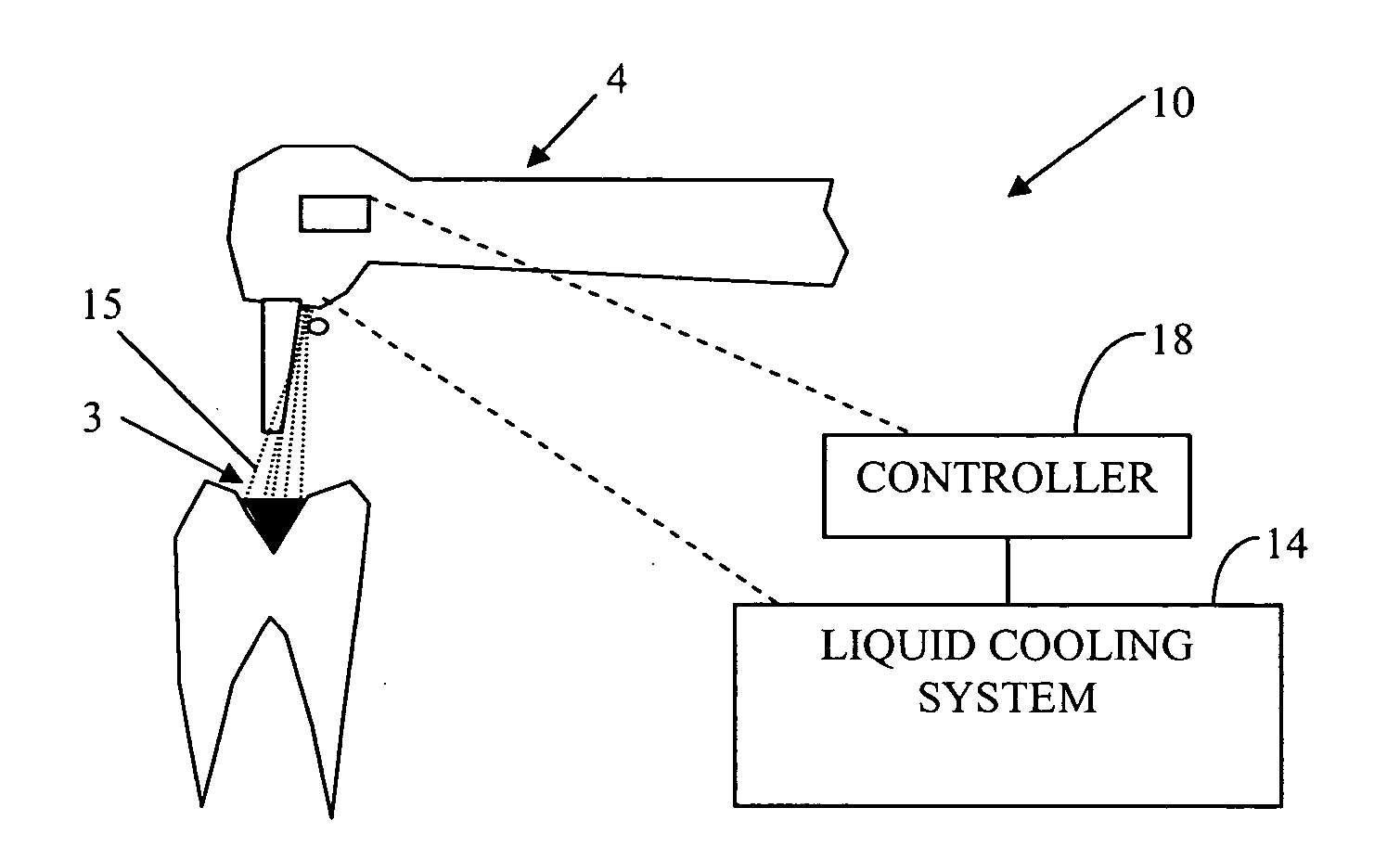 Apparatus and method for treating dental tissue