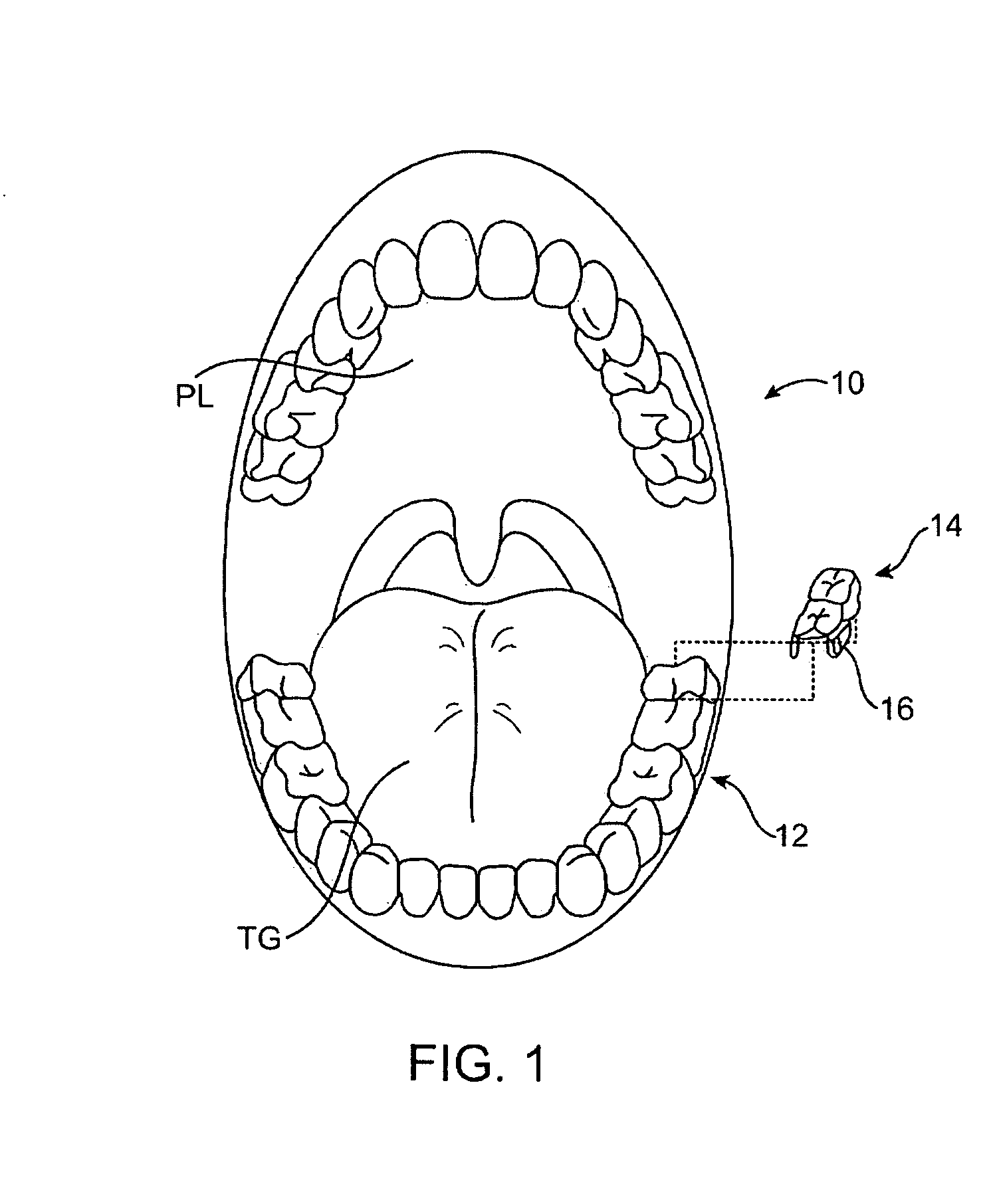 Systems for manufacturing oral-based hearing aid appliances