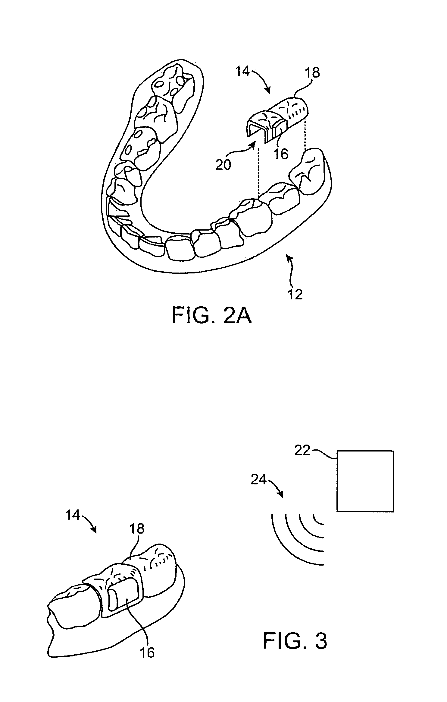 Systems for manufacturing oral-based hearing aid appliances