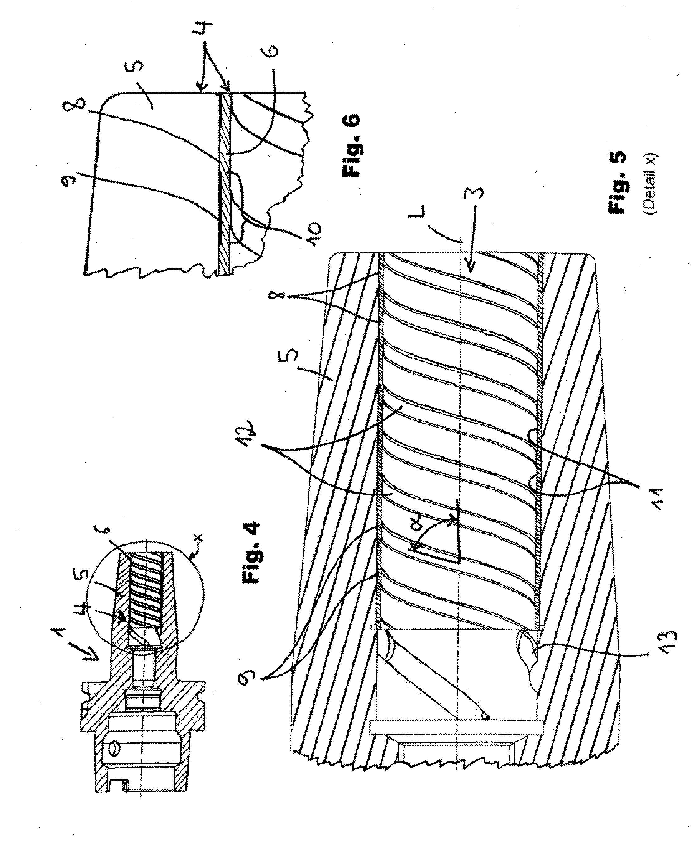 Pre-stressing damping system