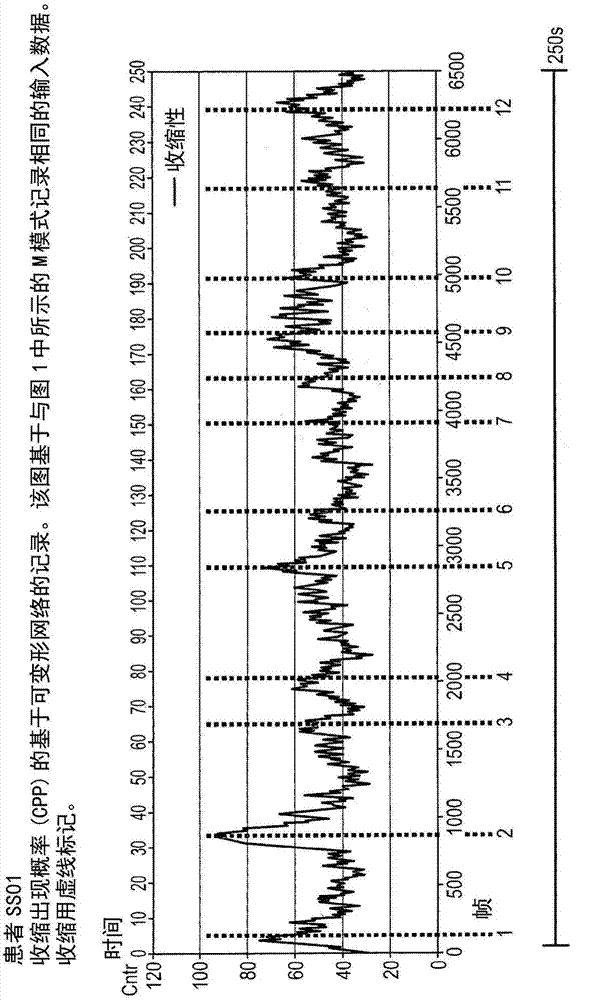 Method and system for diagnosing uterine contraction levels using image analysis