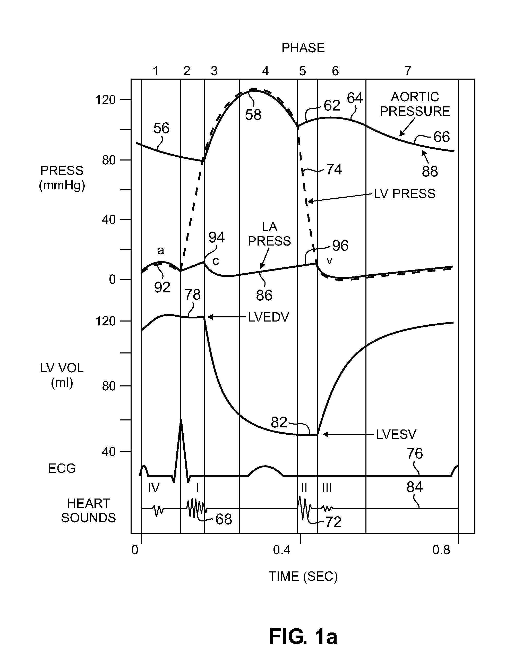 Devices and method for accelerometer-based characterization of cardiac synchrony and dyssynchrony