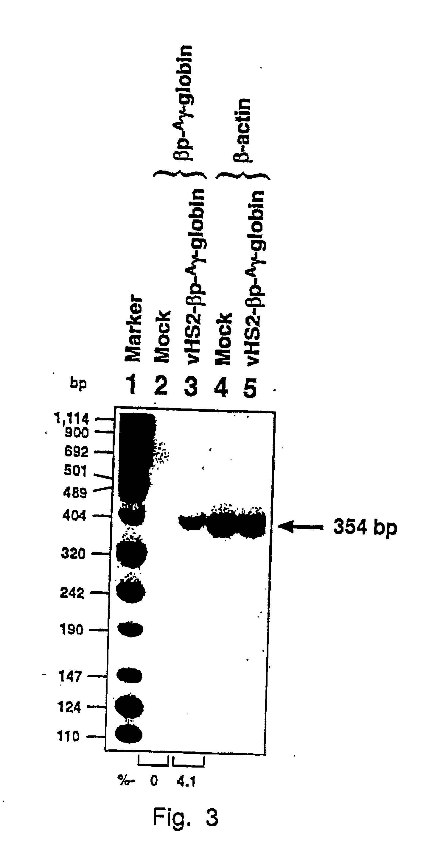 Methods and compositions for liver specific delivery of therapeutic molecules using recombinant AAV vectors