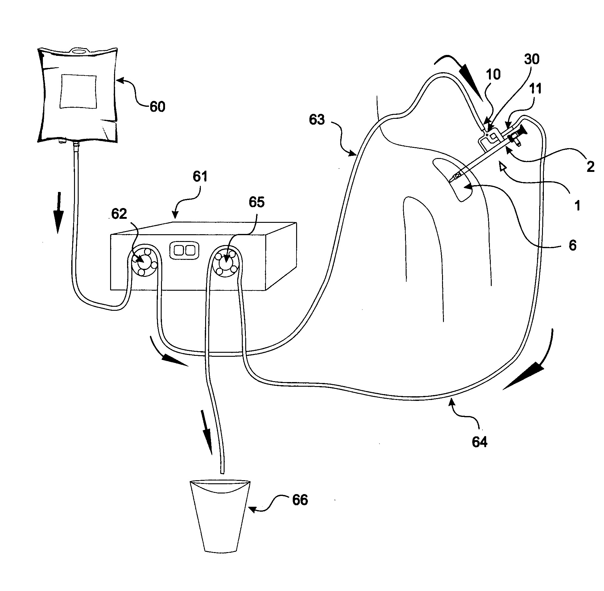 Method and device for flushing during endoscopic surgery
