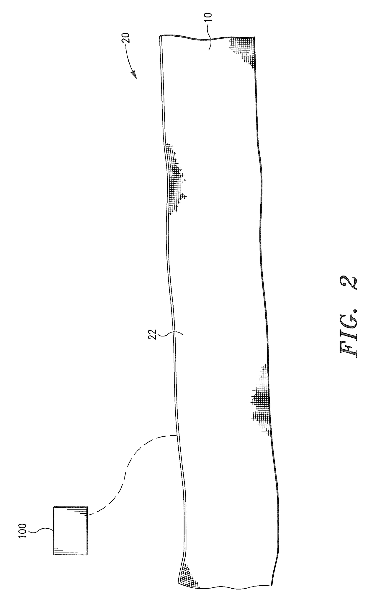 Capacitive Electrocardiography (ECG) Systems