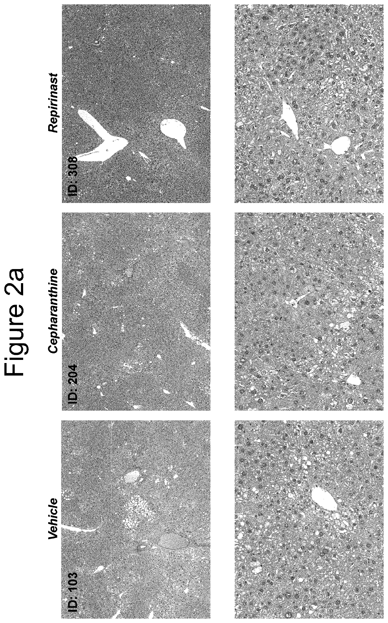 Compositions and methods for treating non-alcoholic steatohepatitis