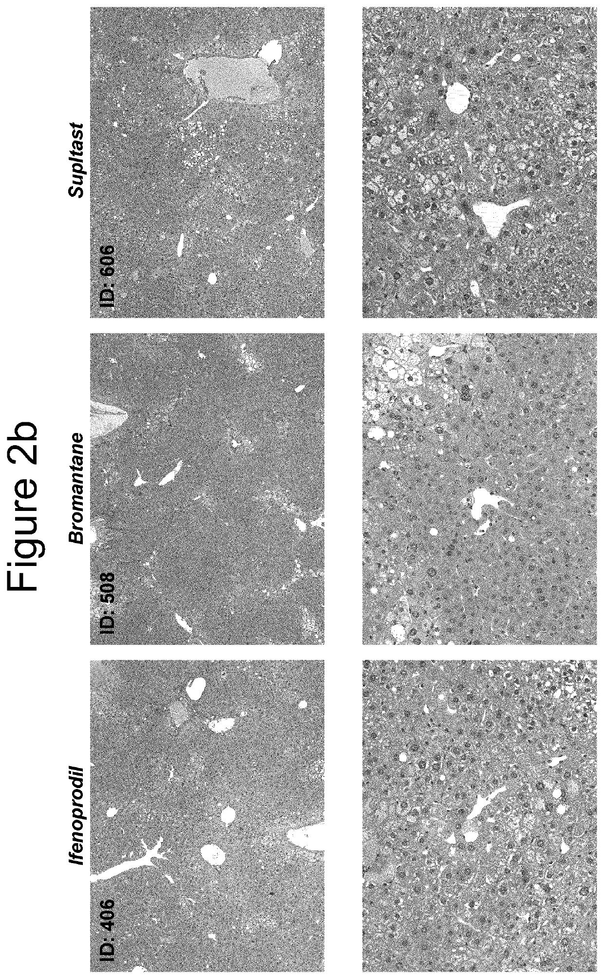 Compositions and methods for treating non-alcoholic steatohepatitis