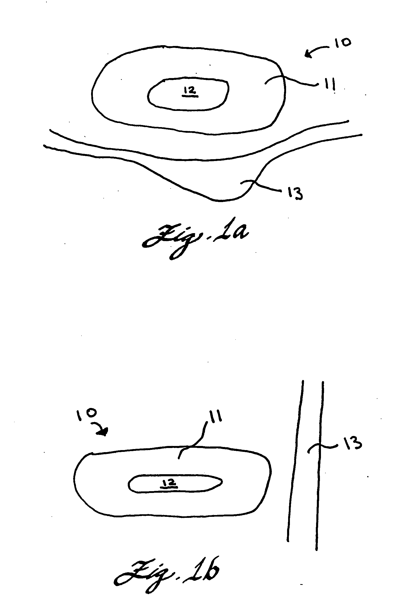 Expandable implant for repairing a defect in a nucleus of an intervertebral disc