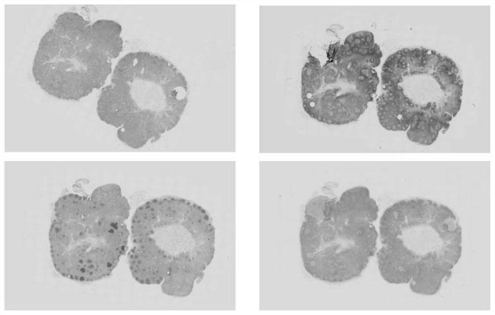 Immunohistochemical digital slide reading system and method