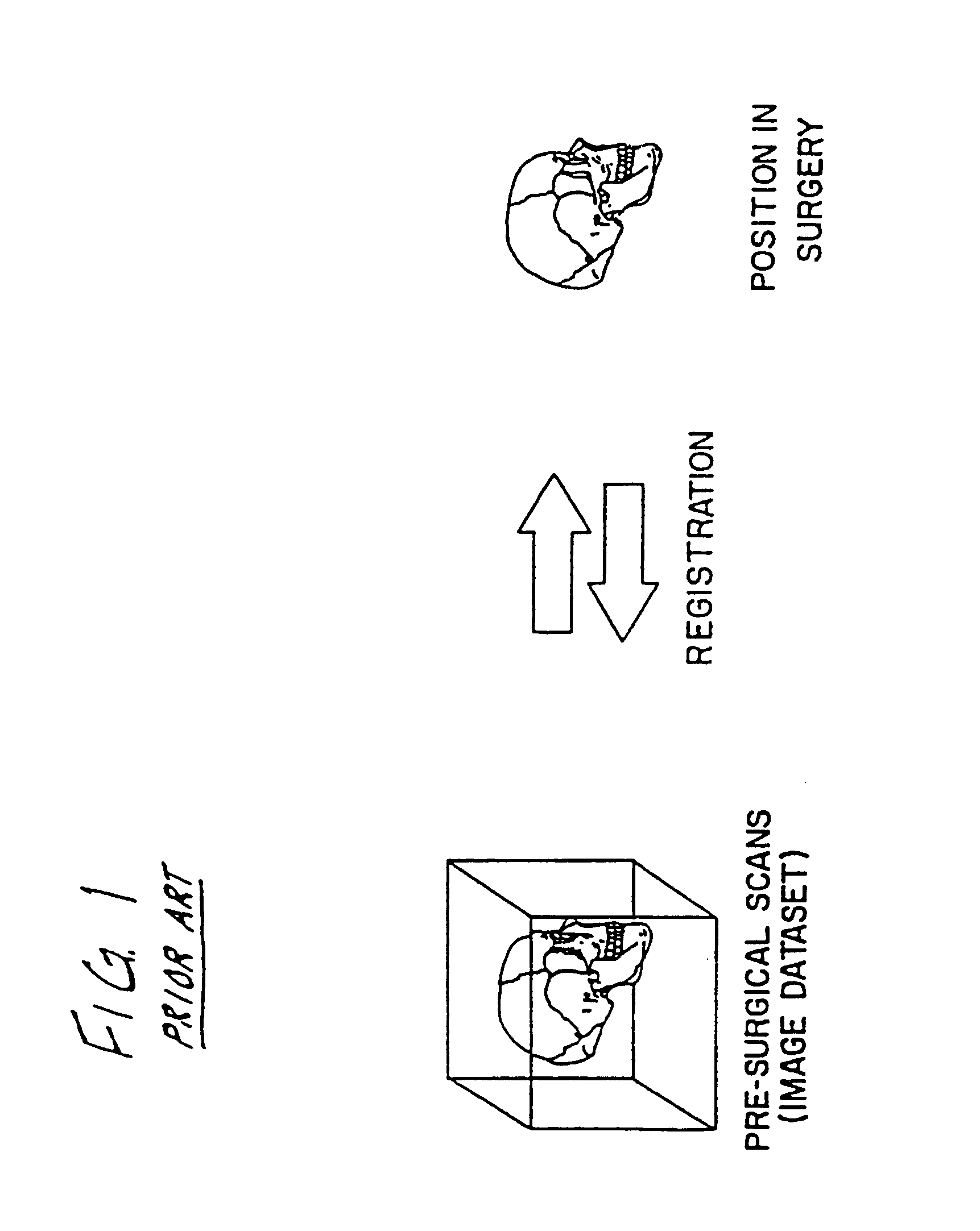 Surgical navigation systems including reference and localization frames