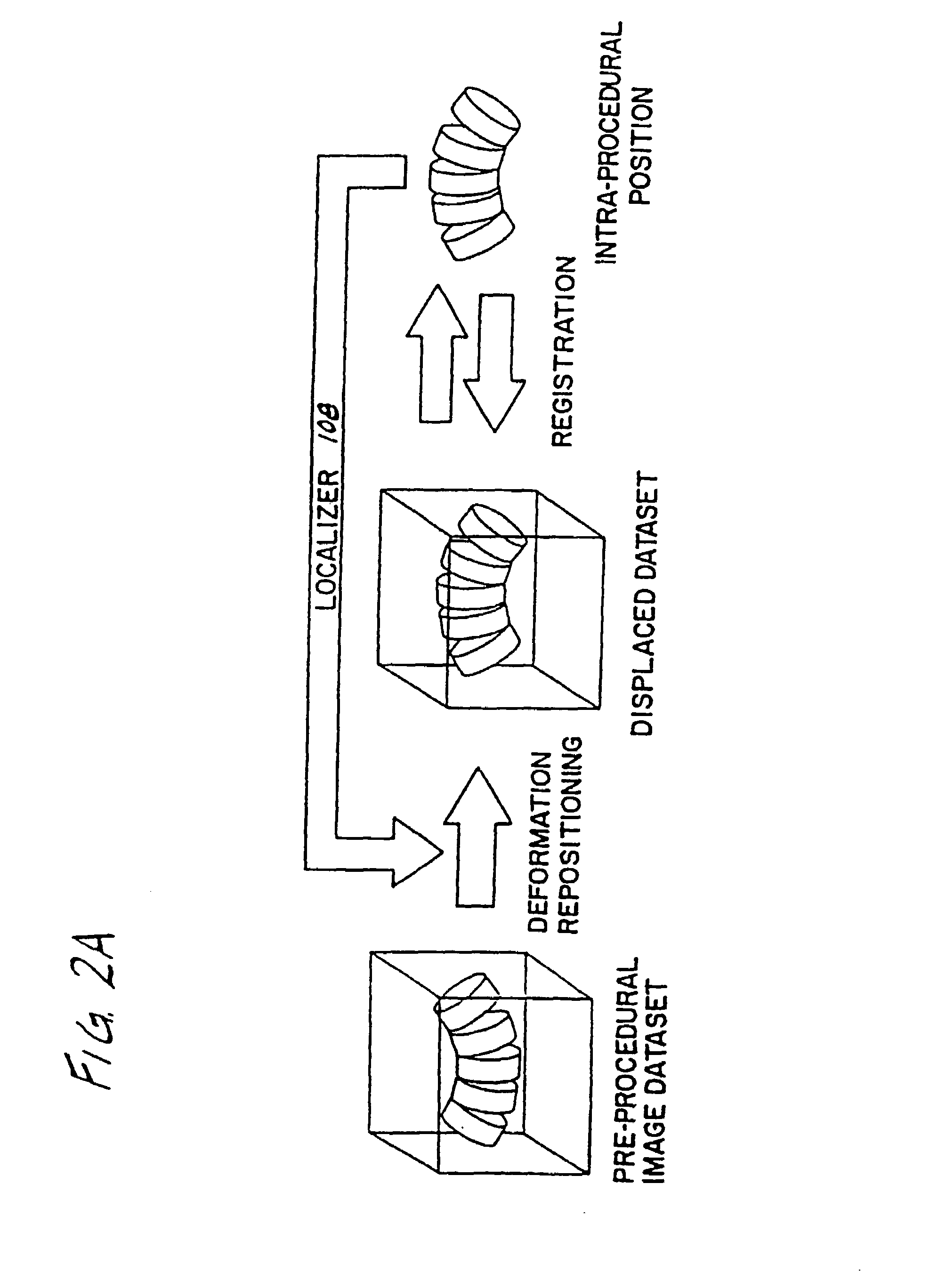 Surgical navigation systems including reference and localization frames