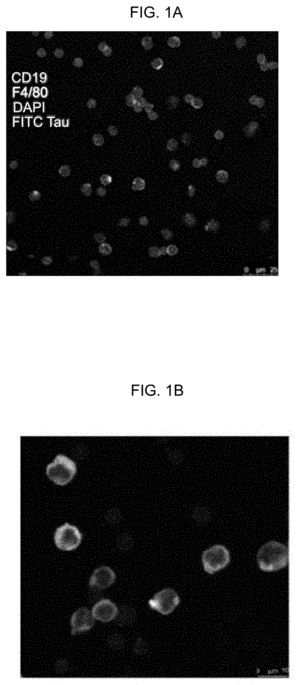 B-1a lymphocyte and/or macrophage targeting and activation to treat medical conditions with inflammatory or autoimmune components