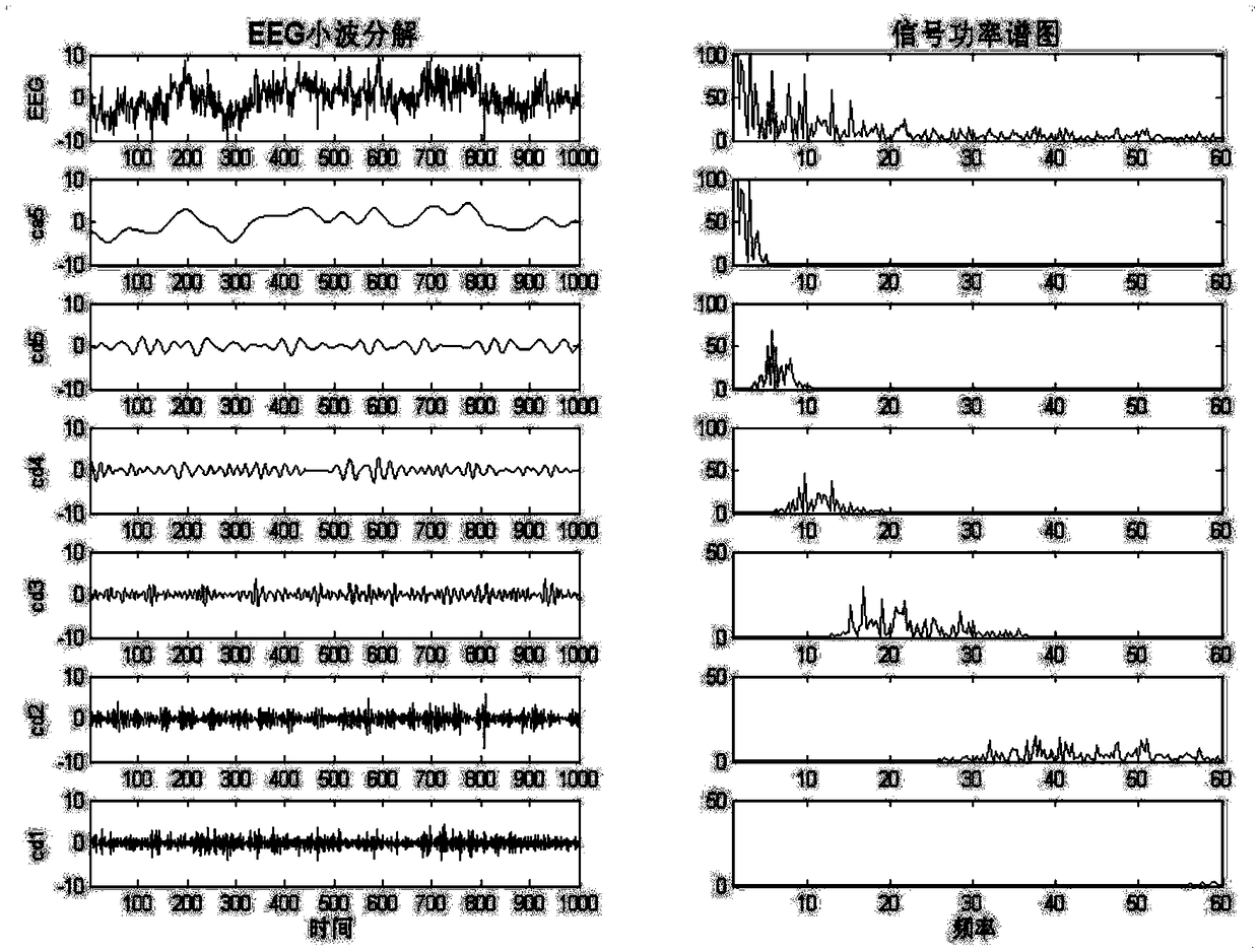 Establishment method for ADHD diagnosis model, storage module and processing equipment