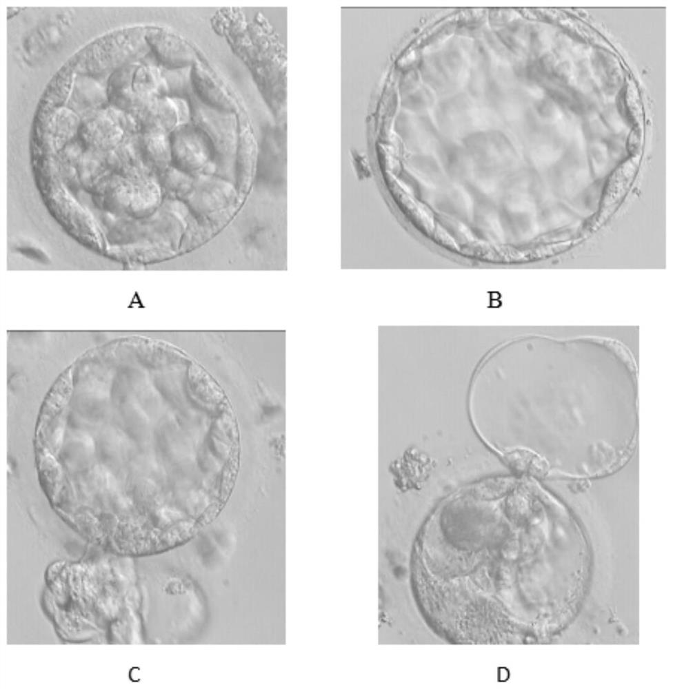 Application of NAD signal channel agonist in in-vitro embryo culture