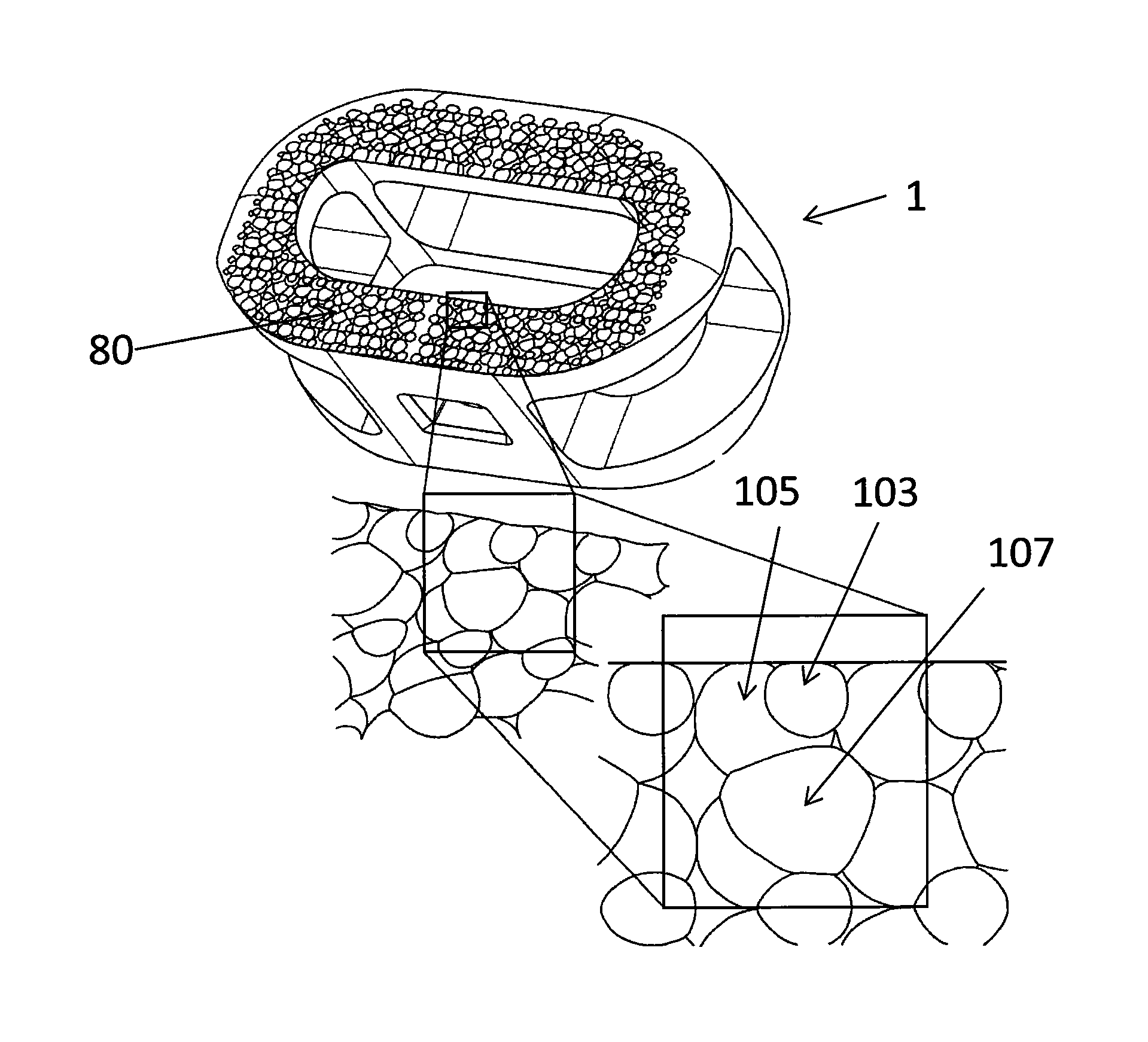 Implants having three distinct surfaces