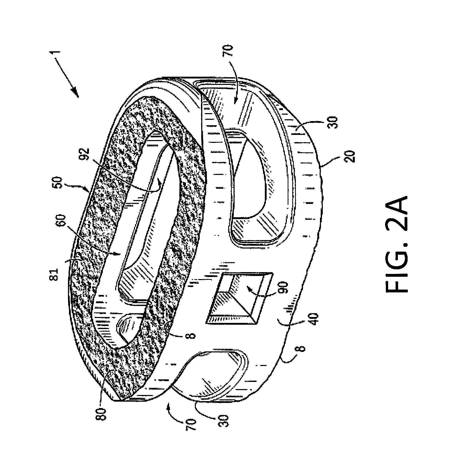 Implants having three distinct surfaces