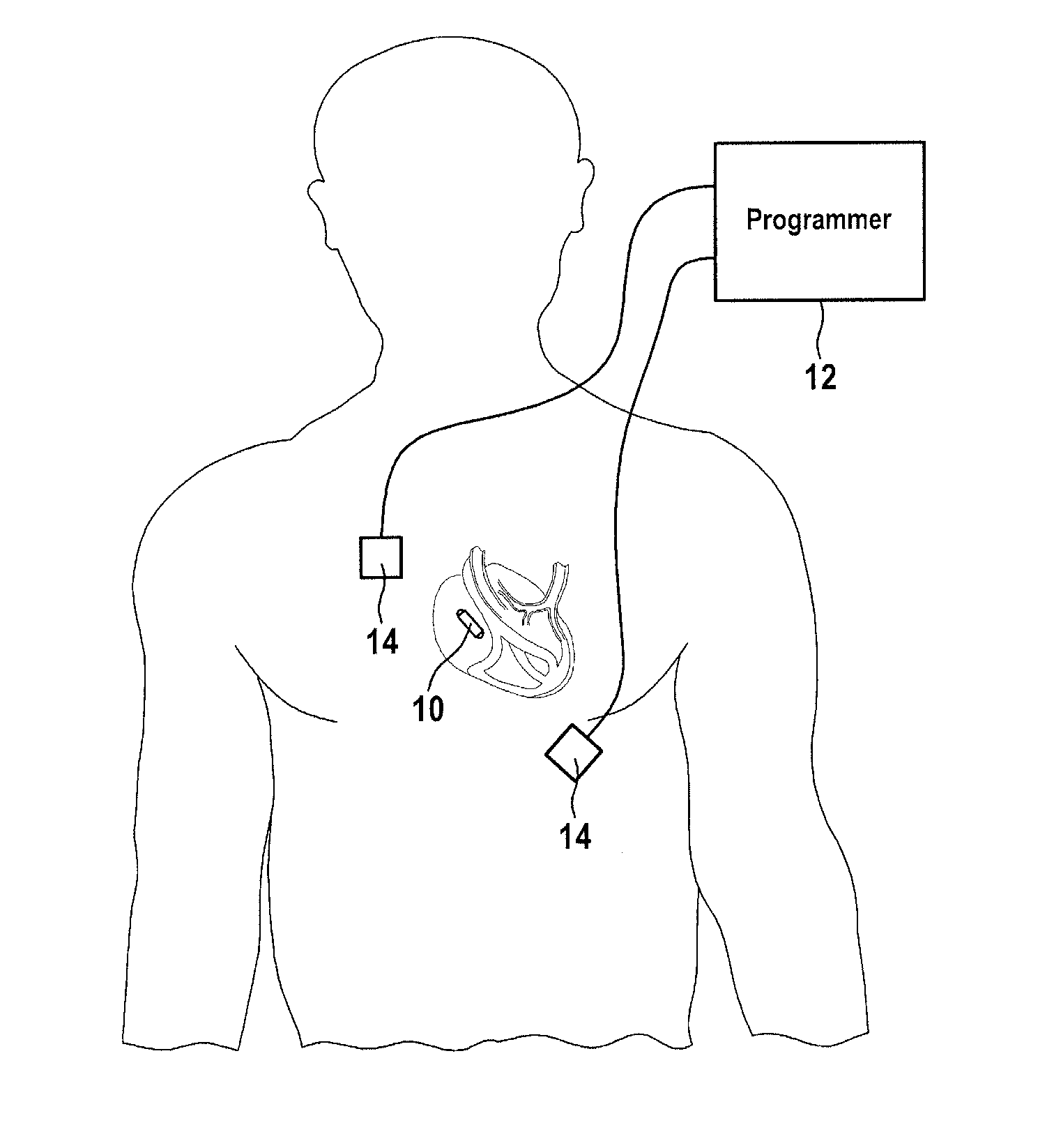 Implantable medical device, medical system and method for data communication
