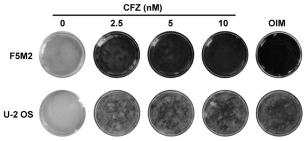 Application of carfilzomib in preparation of medicine for treating osteosarcoma