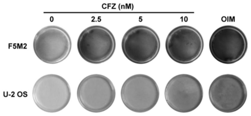 Application of carfilzomib in preparation of medicine for treating osteosarcoma