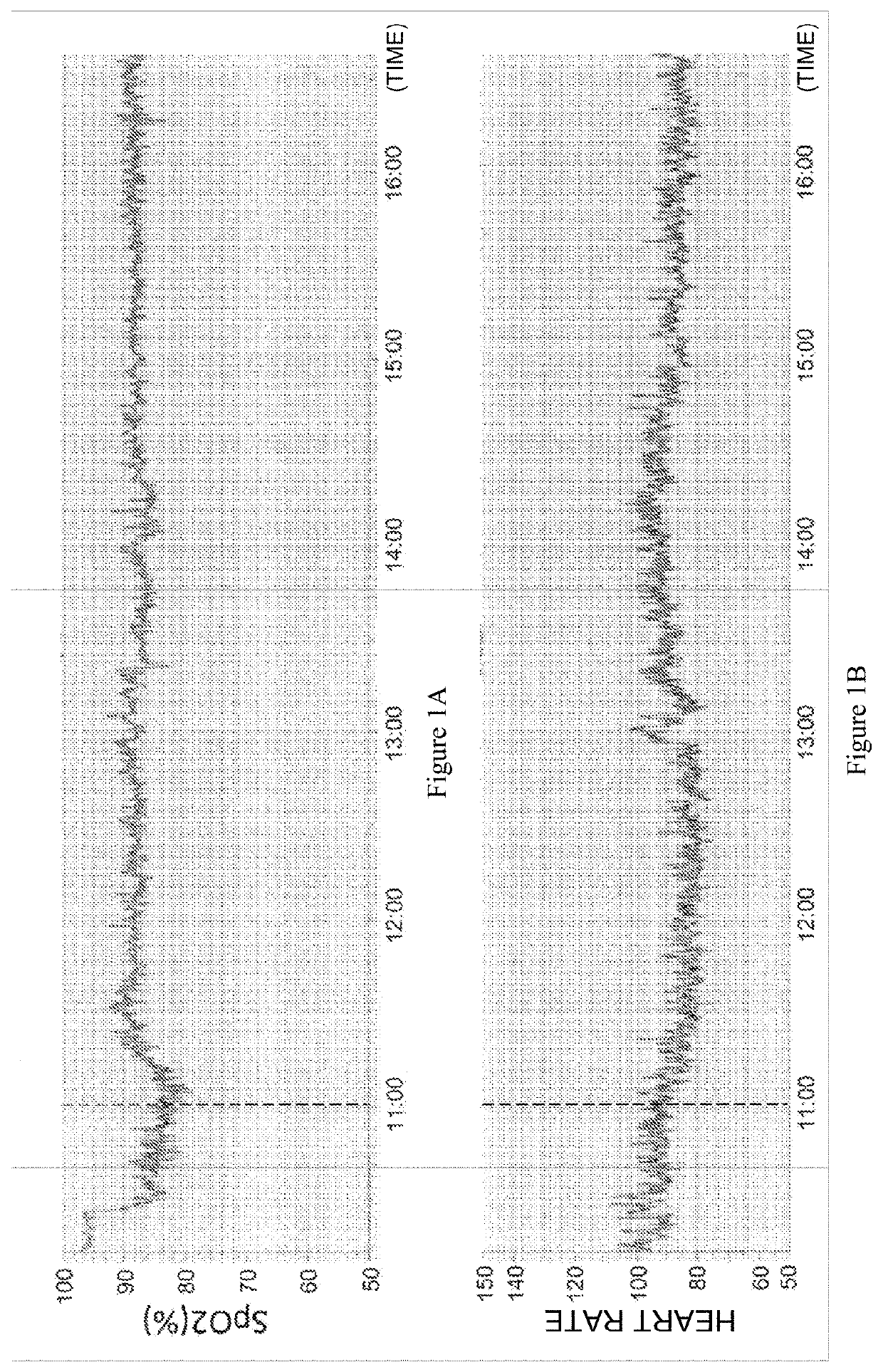 Arterial Oxygen Saturation Degree Improver